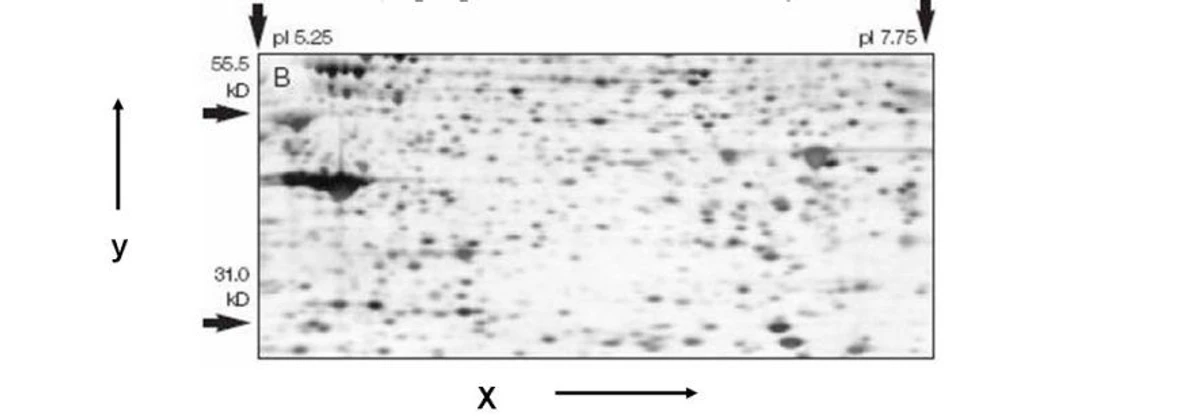 2 THETA: Příklad dvourozměrné proteinové mapy získané 2D-gelovou elektroforézou [13].