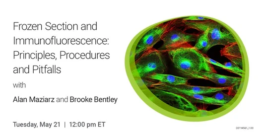 Frozen Section and Immunofluorescence: Principles, Procedures and Pitfalls