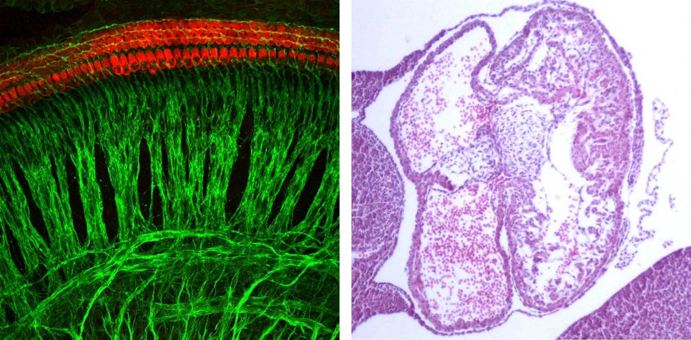 BIOCEV: úvod - cochlea and heart.