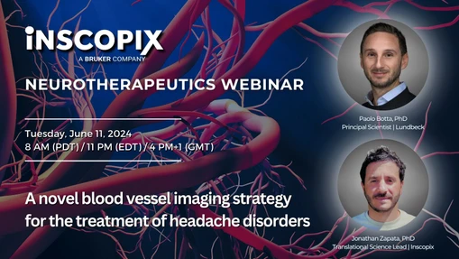 A novel blood vessel imaging strategy for the treatment of headache disorders