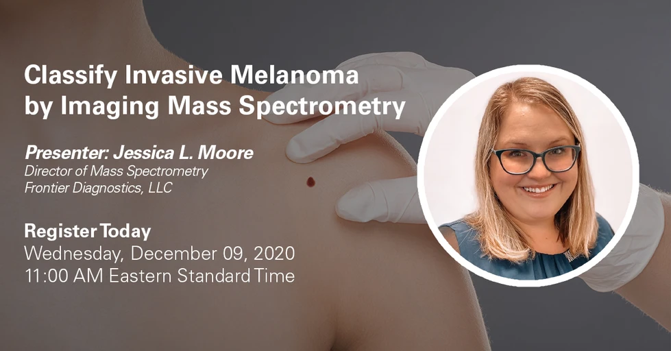 Bruker Daltonics: Classification of Invasive Melanoma by Imaging Mass Spectrometry