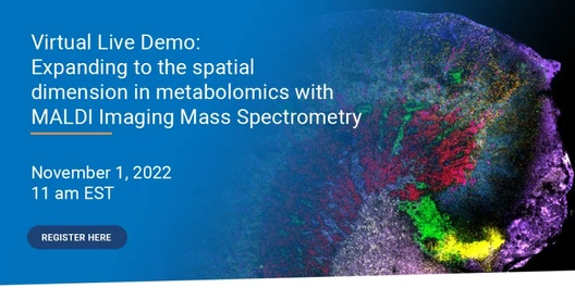 Expanding to the spatial dimension in metabolomics with MALDI Imaging Mass Spectrometry