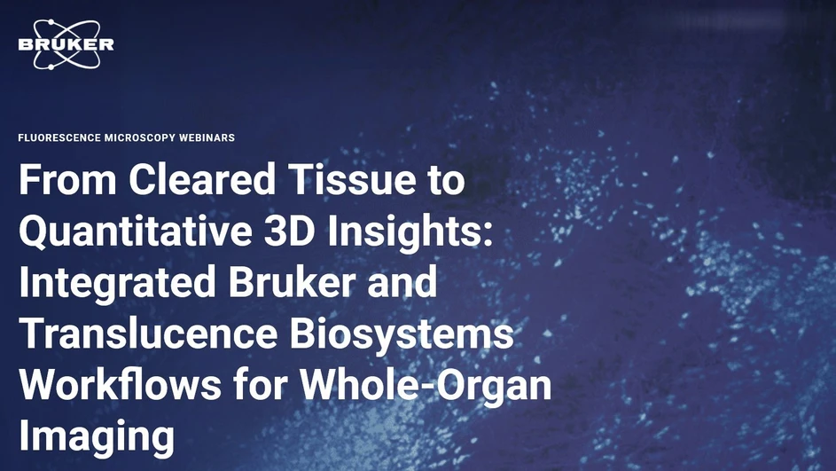 Bruker: From Cleared Tissue to Quantitative 3D Insights: Integrated Bruker and Translucence Biosystems Workflows for Whole-Organ Imaging
