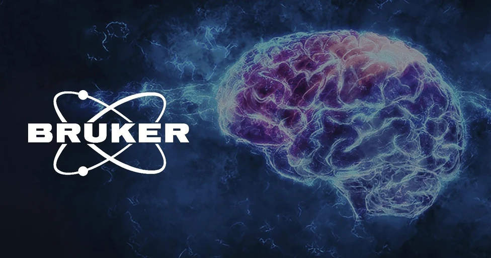 Bruker: From Neural Recording to Functional Insight: Accelerating Discovery with the Inscopix Integrated Workflow