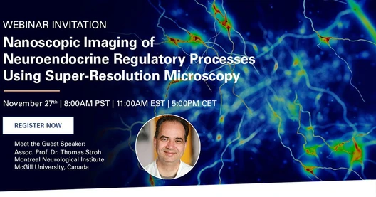 Nanoscopic Imaging of Neuroendocrine Regulatory Processes Using Super-Resolution Microscopy