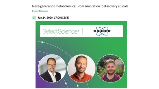 Next‑generation metabolomics: From annotation to discovery at scale
