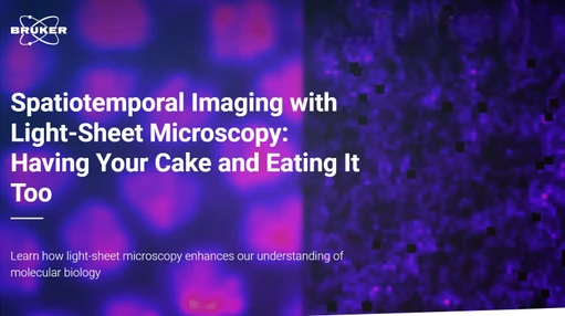 Spatiotemporal Imaging with Light-Sheet Microscopy: Having Your Cake and Eating It Too