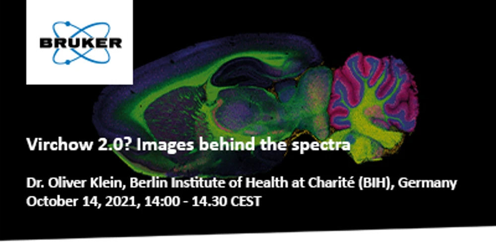 Bruker: Virchow 2.0? Images behind the spectra