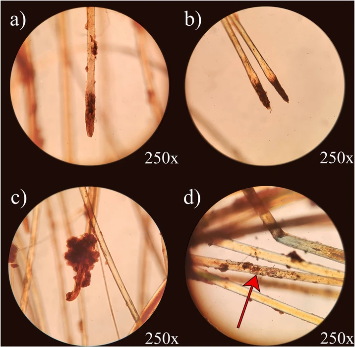 Forensic Sci. Int.: Synergy, 2026, 100661, Volume 12: Fig. 1. G-009 Hair Under the Microscope – Photographs of the G-009 hair from under the occipital bone in plane polarized light depicting a) a hard keratinized point (250x); b) two hard keratinized points (250x); c) soil encased root (250x); and d) plant and fungal activity (250x).