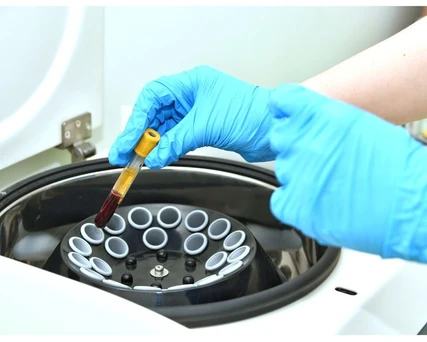 When is Evaporation Under Vacuum Helpful?