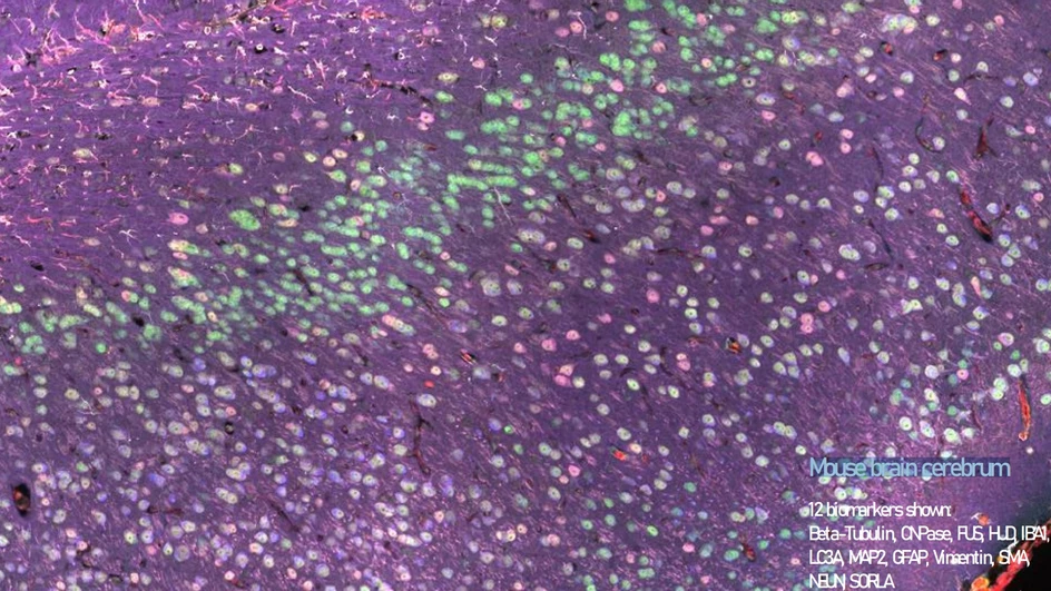 Pragolab: Mouse brain cerebrum