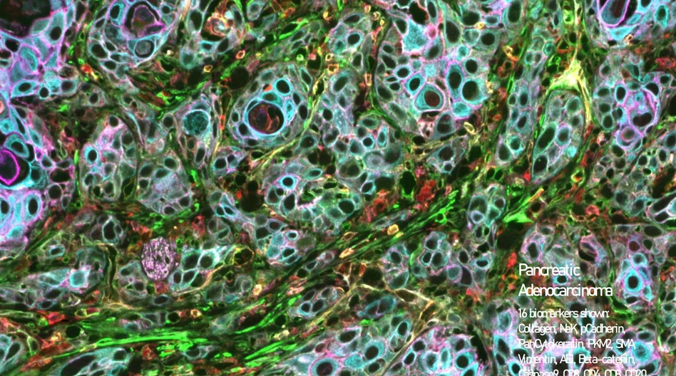 Pragolab: Pancreatic Adenocarcinoma
