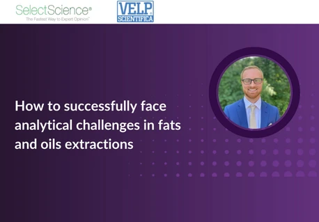 How to successfully face analytical challenges in fats and oils extractions