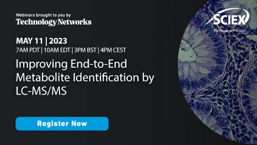 Improving End-to-End Metabolite Identification by LC-MS/MS