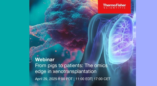 From pigs to patients: The omics edge in xenotransplantation
