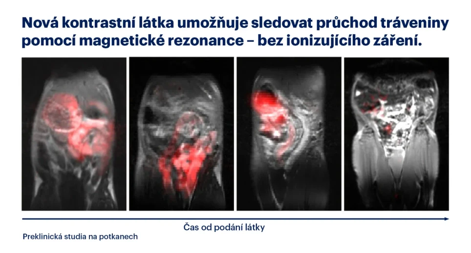 IOCB Prague: A new polymer could enable gastrointestinal transit monitoring without ionizing radiation: The passage of a polymeric contrast agent through the digestive tract of a rat over time. Its signal, detected using ¹⁹F magnetic resonance imaging (¹⁹F MRI), is shown in red.