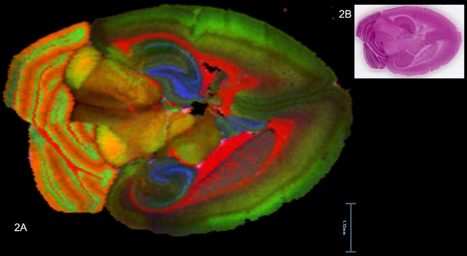 Waters: Obrázek 2A: DESI MS imaging obraz myšího mozku (modrá m/z 808.59 - PC (38:5); červená m/z 788.62 - PC (36:2); zelená m/z 806.57 - PC (38:6); oranžová m/z 834.60 - PC (40:6); růžová m/z 616.18 - heme). Obrázek 2B: H&E obarvený řez myšího mozku.