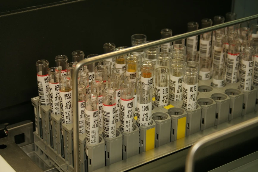 Pixabay/Roman Paroubek: Analytical strategies to improve data quality in biomarker discovery