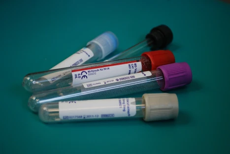 Clinical analysis of perfluoroalkyl substances (PFASs) in human serum by LC-MS/MS using Captiva EMR-Lipid cleanup