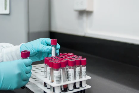 Maximalizujte produktivitu lipidové analýzy s hmotnostním spektrometrem Thermo Scientific TSQ Altis Plus
