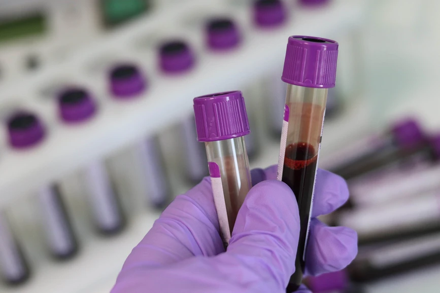 Pixabay/Belova59: Evosep One in the Clinical Biochemistry Lab