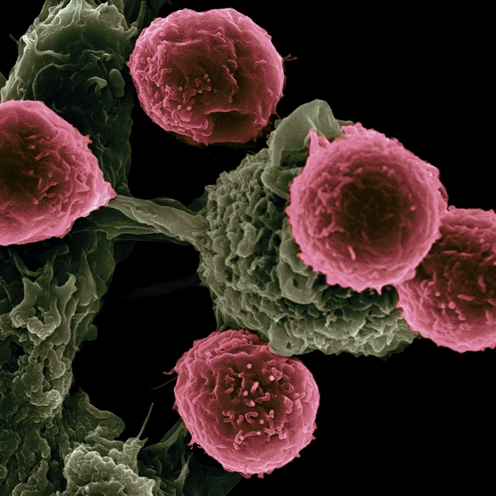 Discovering Reprogrammed Molecular Pathways in Cancer Metastasis With MALDI Imaging