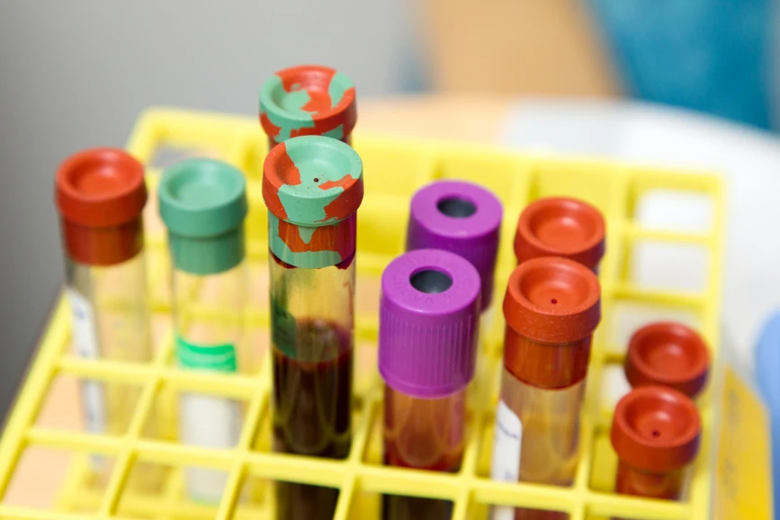 Unsplash/National Cancer Institute: Proteomics Goes 4D to Enhance Understanding of Clotting Diseases