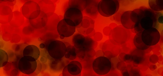 Perfecting Pcats – Developing a More Robust UHPLC-MS/MS Method for Plasma Catecholamines using Low Volume SPE