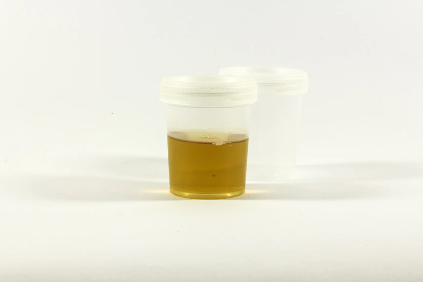 Pixabay/Ewa Urban: Become a Drug Testing Wiz with MS ß-glucuronidases: Simplify your urinalysis workflow