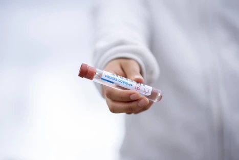Simultaneous Analysis of COVID-19 Drug Candidates in Human Plasma by LC-MS/MS