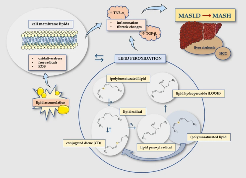 ACS Omega 2026, 11, 23, 33333–33344: Figure 1. Schematic representation of lipid peroxidation and its role in MASLD progression. Lipid accumulation in MASLD leads to the release of free radicals and ROS, which attack (poly)unsaturated fatty acids within membrane lipids, leading to lipid peroxidation, inflammation (via TNF-α), and fibrotic changes (via TGF-β1), thereby contributing to the transition from MASLD to MASH and further progression to cirrhosis and HCC. In lipid peroxidation, reactive radicals (R·) subtract the hydrogen from the (poly)unsaturated lipid, thereby resulting in the formation of a lipid radical, which undergoes rearrangements to form a CD. The lipid radical then reacts with molecular oxygen to form an unstable lipid peroxyl radical, which further subtracts a hydrogen from another (poly)unsaturated lipid, thereby resulting in the formation of a LOOH. The subtraction of hydrogen from the (poly)unsaturated lipid also results in the formation of a lipid radical, thereby perpetuating the chain reaction. The figure was created with Servier Medical Art (https://smart.servier.com/) and MarvinSketch (ChemAxon, https://chemaxon.com/marvin).