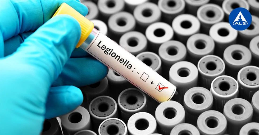 <ul>
<li><strong>Foto:</strong> ALS Czech Republic: Legionella</li>
</ul>
