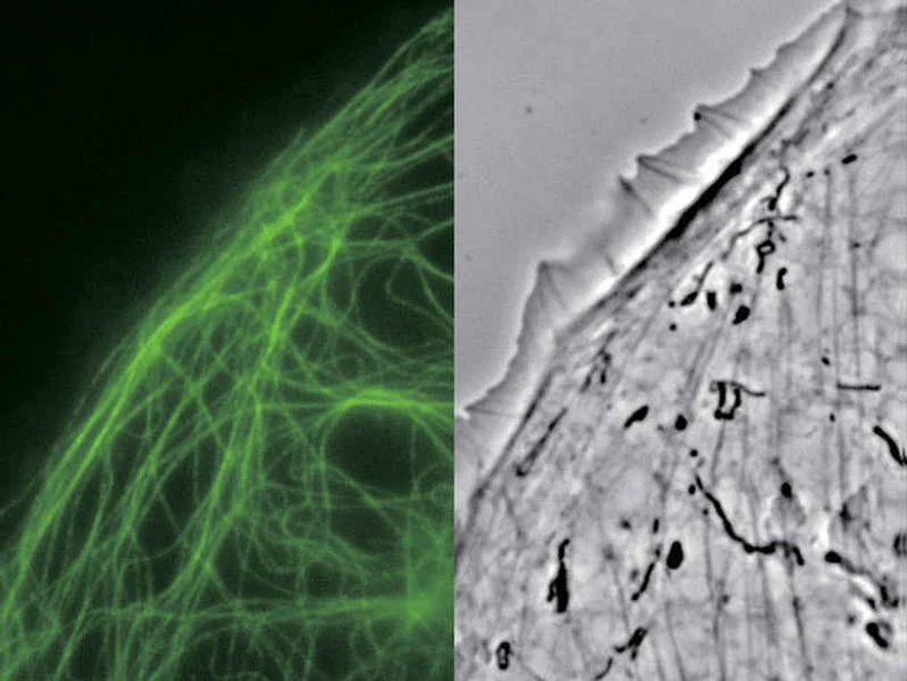 Altium International - Nikon Eclipse Ti2 - Epi-fluorescence a externí fázový kontrast: Buňky PTK-1 značené GFP-alfa-tubulinem zachycené objektivem CFI Apochromat TIRF 100XC Oil.
Snímek použit s laskavým svolením Alexey Khodjakov, PhD. Vědecký pracovník VI / profesor, Wadsworth Center, zdroj webové stránky Nikon