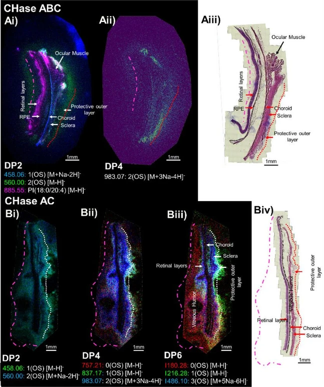 Anal. Chem. 2024, 96, 45, 17969–17977: Figure 3. MALDI-TOF MS images of the GAG oligosaccharides. A) Stacked ion images of a primate retina after CHase ABC treatment shown for DP2 (i) and DP4 (ii), and (iii) the labeled H&E stained section. B) Ion images of a primate retina after CHase AC treatment shown for DP2 (i), DP4 (ii), and DP6 (iii) ions and (iv) the labeled H&E stained section. White/red dotted lines indicate the edge of the protective outer layer and the pink dashed line the edge of the vitreous humor, both of which do not stain well with H&E. Single ion images for all GAG ions can be found in Figures S7 and S9.