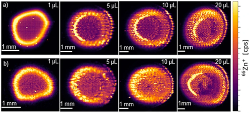 Analytica Chimica Acta, Volume 1355, 2025, 343999: Fig. 1. Signal intensity maps of 66Zn+ in gelatin droplets (volume: 1–20 µL; drying temperature: a) 60 °C, b) 100 °C; gel concentration: 10 % (w/w); matrix (acid concentration): Zn standard solution in 2 % HNO3 spiked into H2O (0.22–0.47 %) obtained by LA-ICP-MS imaging. LA-Parameters for 1 µL: fluence: 1.0 J/cm2; repetition rate: 140 Hz; spot size: 35 µm square shape; fixed dosage mode: 15; dwell times: 66Zn+: 50 ms, 69Ga+: 2 ms, 187Re+: 50 ms. LA-Parameters for 5, 10 and 20 µL: fluence: 1.0 J/cm2; repetition rate: 210 Hz; spot size: 80 µm square shape; fixed dosage mode: 25; dwell times: 66Zn+: 50 ms, 69Ga+: 2 ms, 187Re+: 50 ms.
