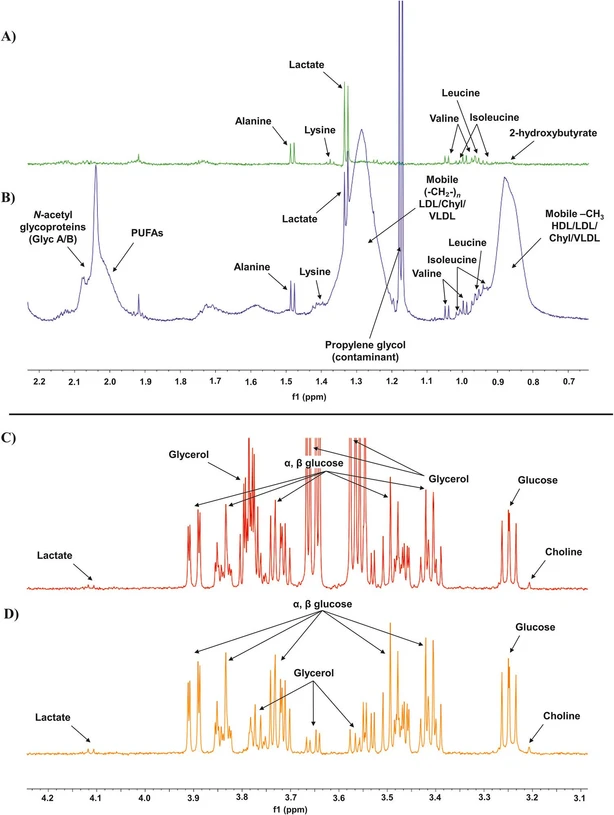 Analytica Chimica Acta, Volume 1356, 2025, 343979: Fig. 7. 1H CPMG NMR spectra of serum samples illustrating the effect of MWCO filtration. (A, B) The 0.7–2.2 ppm spectral region of (A) a 10 kDa MWCO-filtered sample and (B) an unfiltered serum sample in aqueous phosphate buffer. Panel A, compared to panel B, highlights the absence of lipoprotein, PUFA (δ 0.86, 1.28, and 1.99 ppm), N-acetyl glycoprotein (GlycA/B, δ 2.00–2.10 ppm), and propylene glycol contaminant (released from blood collection tubes, δ 1.17 ppm) signals following filtration. (C, D) The 3.1–4.2 ppm spectral region of (C) a 10 kDa MWCO-filtered sample in acetonitrile (distorted by glycerol contamination peaks at δ 3.56 (m), 3.65 (m), and 3.78 (m)); and (D) an acetonitrile-precipitated sample, which contains only physiological glycerol signals. Similar to MWCO-filtered samples in aqueous phosphate buffer, the acetonitrile-precipitated samples also lack signals corresponding to lipoproteins, PUFAs, and N-acetyl glycoproteins. For complete NMR spectra of all extraction methods, refer to SI Figs. 13 and 14.