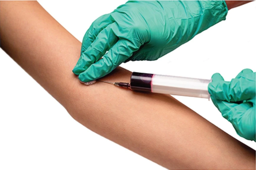 Bioanalytic: Venous blood (Chromsystems procedure)
