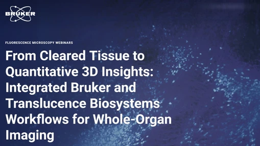 From Cleared Tissue to Quantitative 3D Insights: Integrated Bruker and Translucence Biosystems Workflows for Whole-Organ Imaging