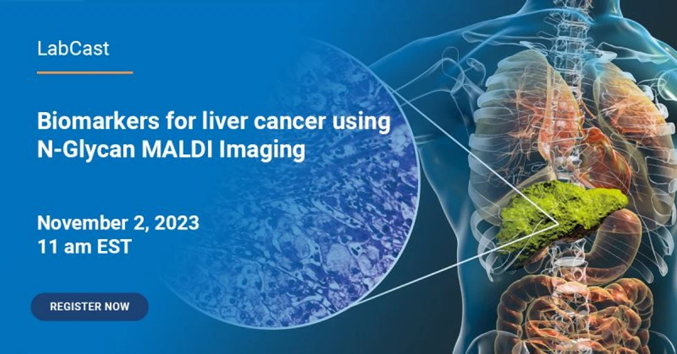 Bruker: LabCast: Biomarkers for liver cancer using N-Glycan MALDI Imaging