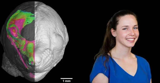 Mother’s protein intake during pregnancy can affect newborn’s facial development