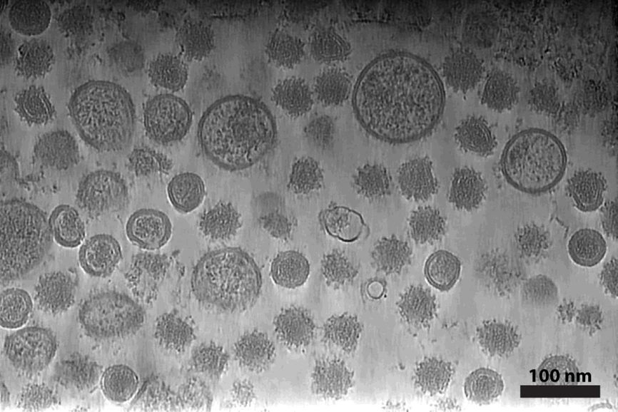 CEITEC/Plevka Lab: Virus klíšťové encefalitidy vědce překvapil: objevili „lysiny“ v jeho obalu: Tomografická analýza částic viru klíšťové encefalitidy odhaluje nepravidelný tvar virových částic.