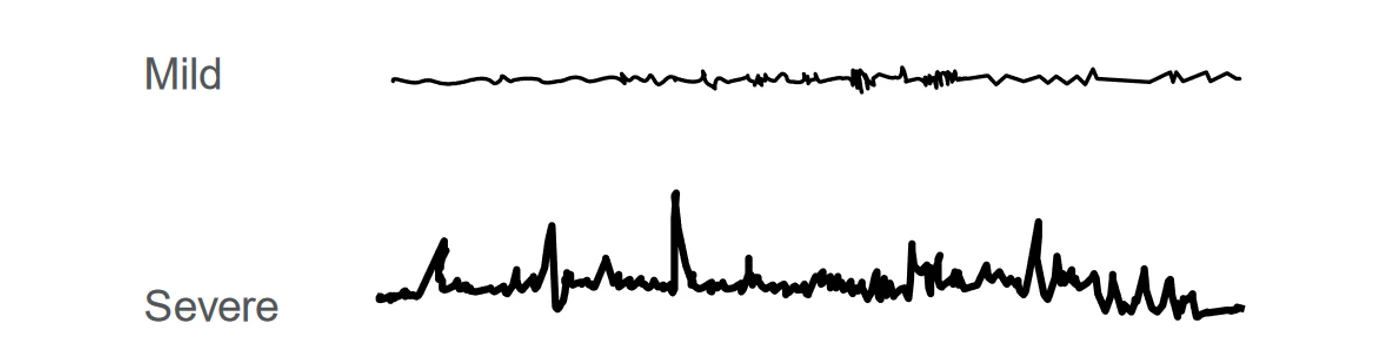 HPST: Baseline a šum