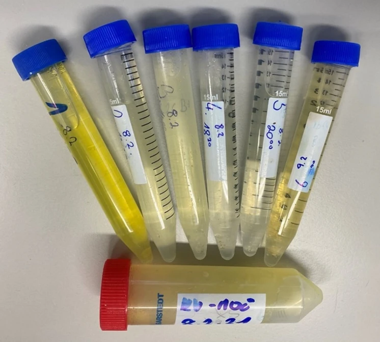Obrázek 10. Vzorky šesti frakcí močí v průběhu dne 8. 2. 2021 a denní směsný vzorek.
