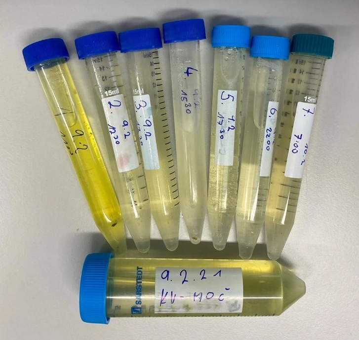 Obrázek 13. Vzorky sedmi frakcí močí v průběhu dne 9. 2. 2021 a denní směsný vzorek.