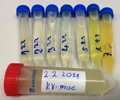 Vliv stravy na antioxidační aktivitu lidské moče
