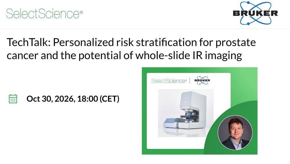 SelectScience: Personalized risk stratification for prostate cancer and the potential of whole-slide IR imaging