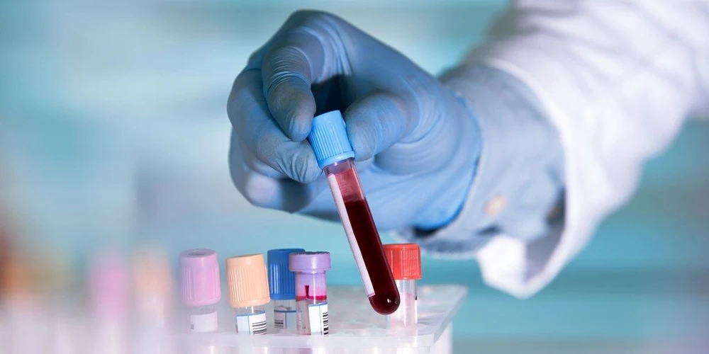 <p><strong>Thermo Fisher Scientific:</strong> Cutting-Edge Triple Quad ICP-MS for Clinical Trace Element Analysis</p>