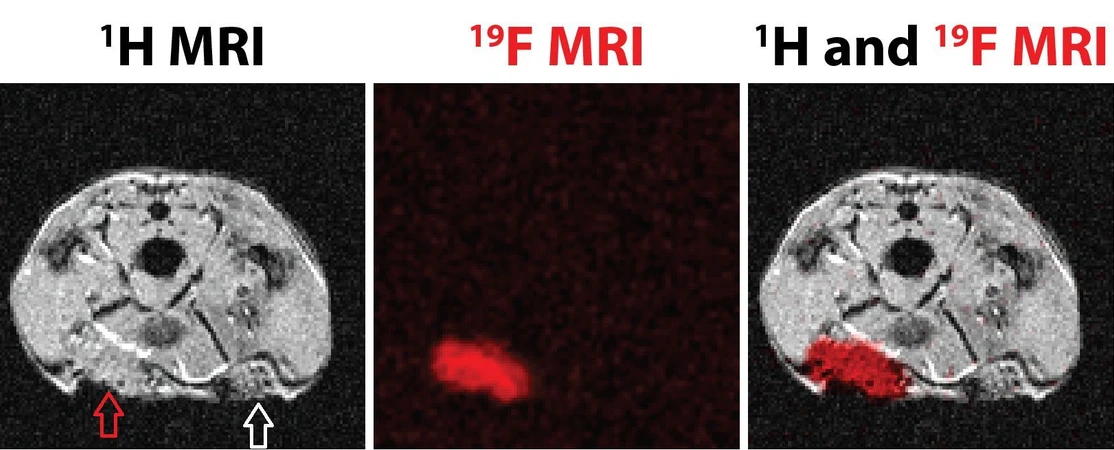 IOCB PRague: Scientists from IOCB Prague have improved materials for reconstructive and plastic surgery. (Left) Classical magnetic resonance imaging of a rat (¹H MRI), a transverse section at approximately the waist. The red arrow points to the implantation site of the new (fluorinated) implant; the white arrow points to the implantation site of the older type of implant. (Middle) Imaging of the same part of a rat but with the fluorine imaging method (¹⁹F MRI), the shape of the new implant is clearly visible in the image but the older type is not. (Right) Combining the ¹H MRI image and the ¹⁹F MRI image shows the size and shape of the implant and its anatomical location.