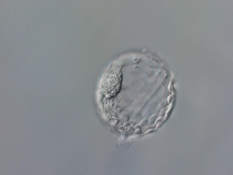 IOCHB Prague: A study in Nature sheds new light on DNA repair in early human embryos, with implications for future gene correction: A human embryo at the blastocyst stage, in whose DNA Dieter Egli's group performed base editing in the PCSK9 and HBG genes. Credit: Štěpán Jeřábek (Columbia University and IOCB Prague).