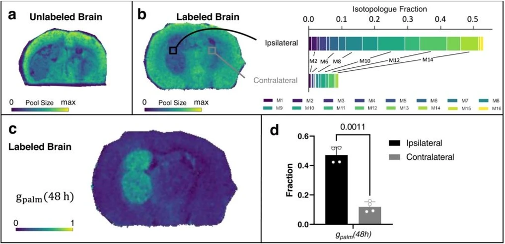 Washington University in St. Louis: Spatial metabolomics images of a brain with a tumor. Additional details available in Figure 8 from the technical article, “Using mass spectrometry imaging to map fluxes quantitatively in the tumor ecosystem.” (Image courtesy of Patti lab, Nature Communications)